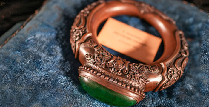 Cosa sono gli anelli di varo?